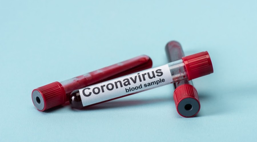 Coronavirus testing